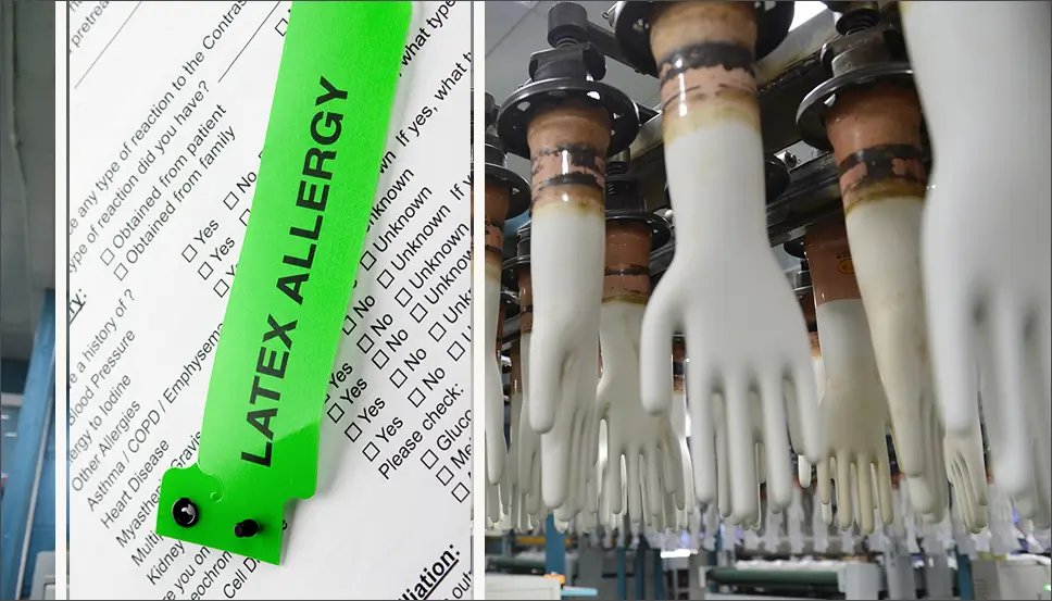 Die Ursachen von Latex Allergien und wie man sie reduzieren kann. Die Ursachen von Latex Allergien und wie man sie reduzieren kann.